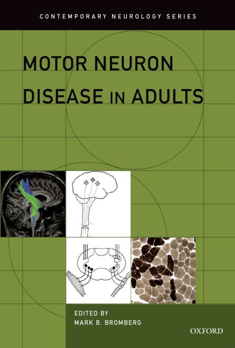 Cover image for book Motor Neuron Disease in Adults