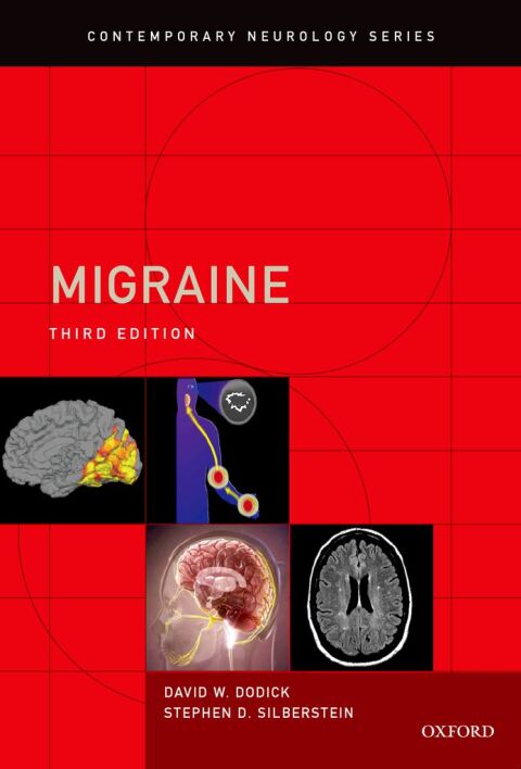 Cover image for book Migraine