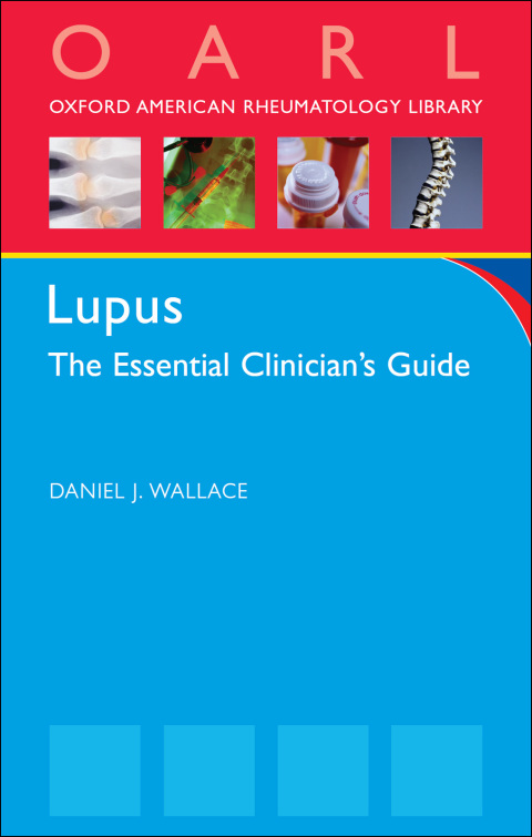 Cover image for book Lupus