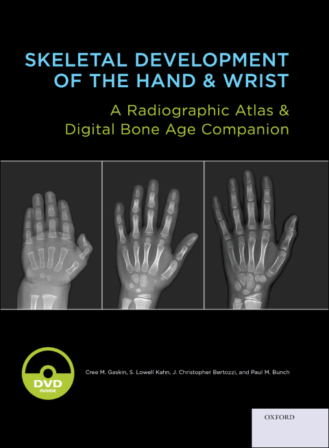 Cover image for book Skeletal Development of the Hand and Wrist