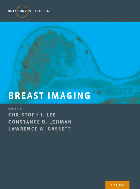 Cover image for book Breast Imaging