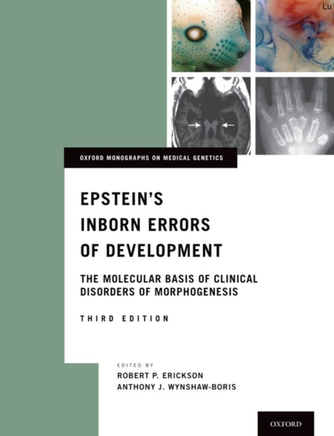 Cover image for book Epstein's Inborn Errors of Development