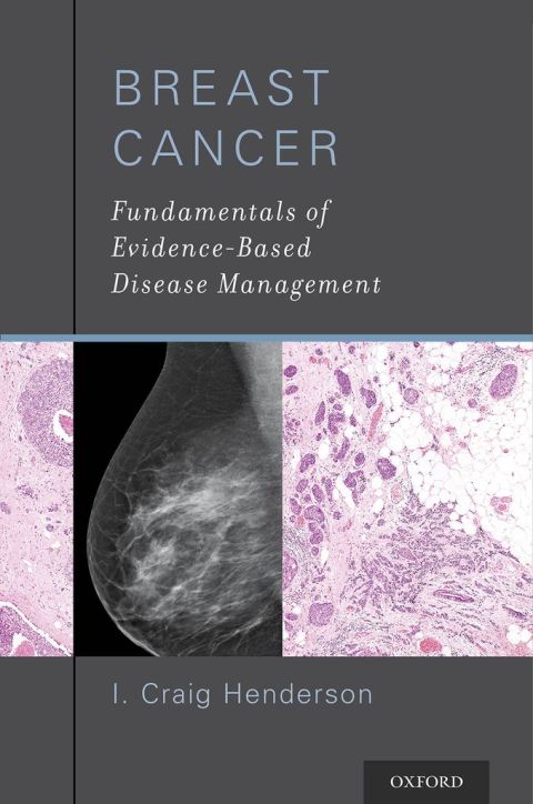 Cover image for book Breast Cancer