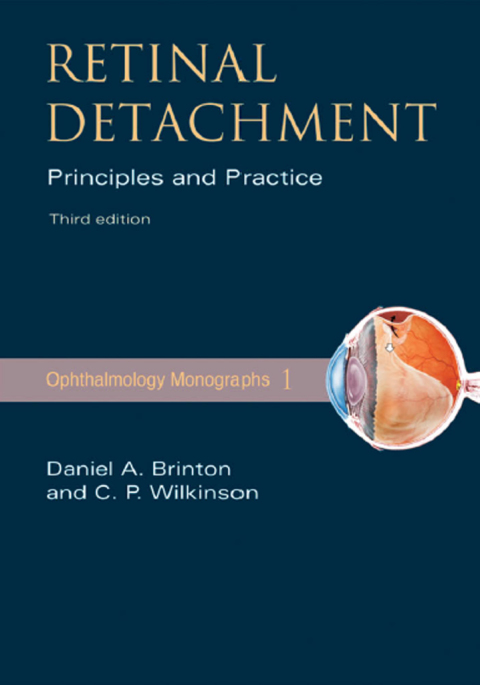 Cover image for book Retinal Detachment