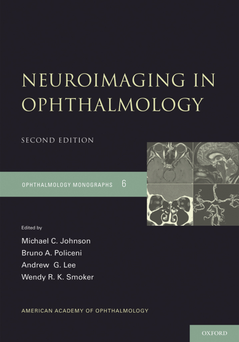 Cover image for book Neuroimaging in Ophthalmology