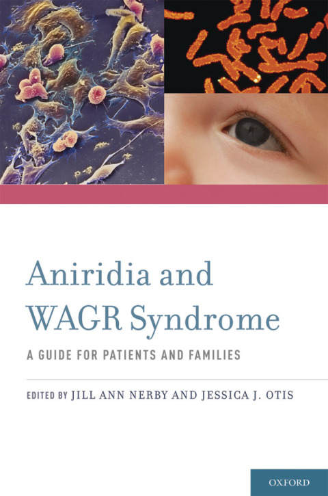 Cover image for book Aniridia and WAGR Syndrome