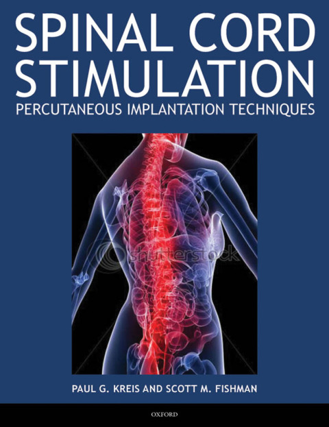 Cover image for book Spinal Cord Stimulation