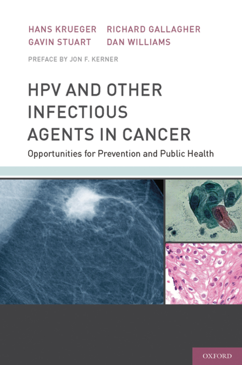 Cover image for book HPV and Other Infectious Agents in Cancer