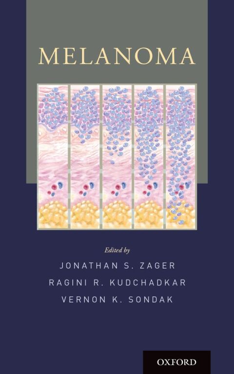Cover image for book Melanoma