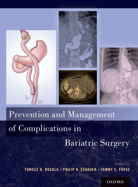 Cover image for book Prevention and Management of Complications in Bariatric Surgery