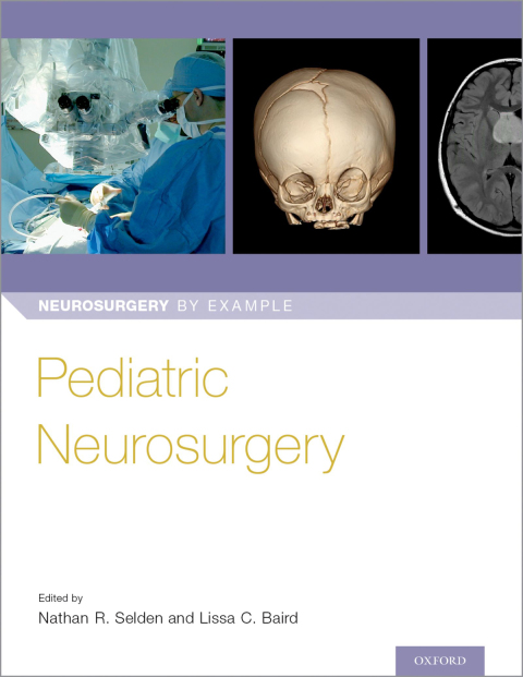 Cover image for book Pediatric Neurosurgery