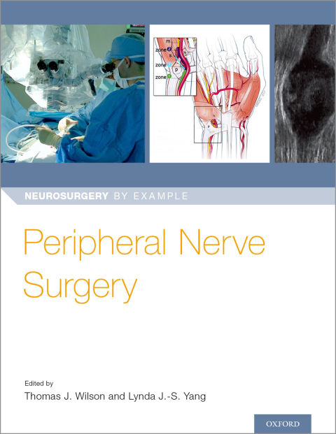 Cover image for book Peripheral Nerve Surgery