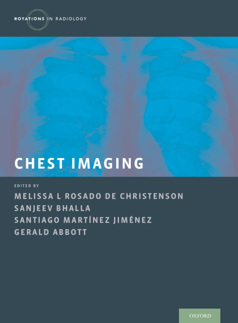 Cover image for book Chest Imaging