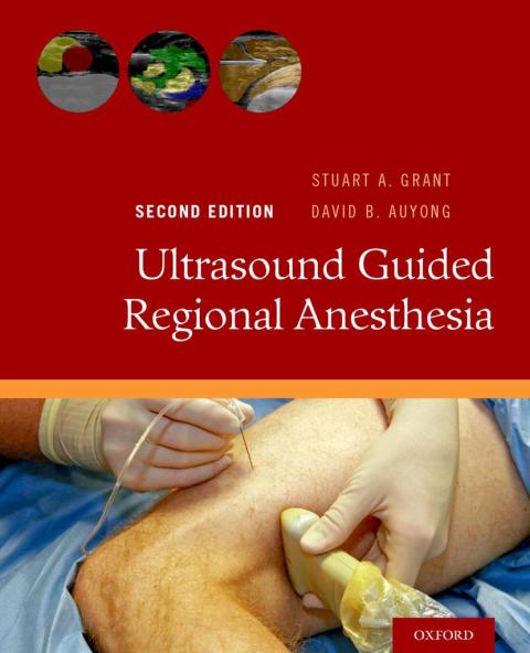 Cover image for book Ultrasound Guided Regional Anesthesia