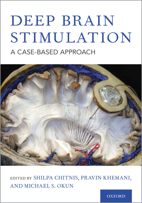 Cover image for book Deep Brain Stimulation