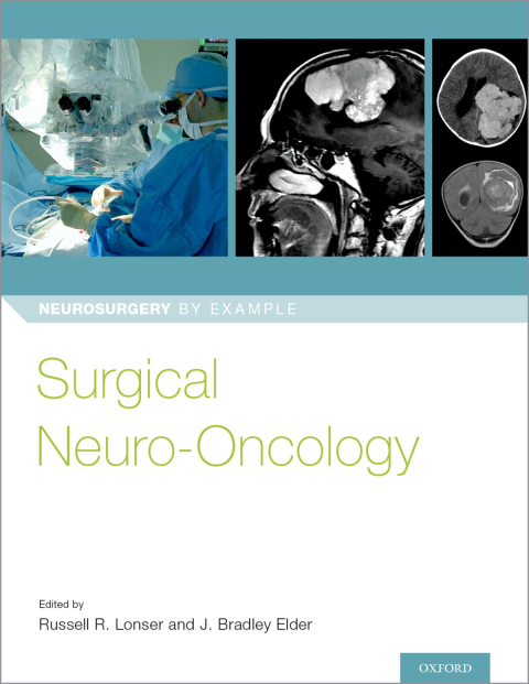 Cover image for book Surgical Neuro-Oncology