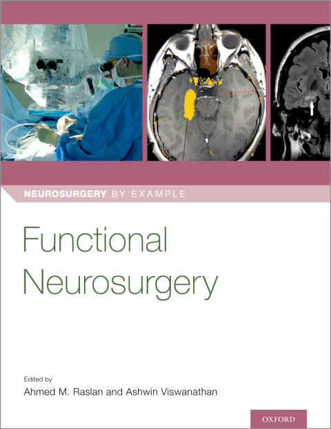 Cover image for book Functional Neurosurgery