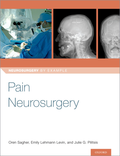 Cover image for book Pain Neurosurgery