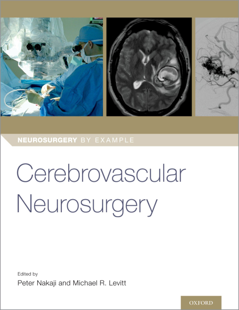 Cover image for book Cerebrovascular Neurosurgery