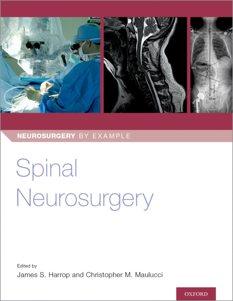 Cover image for book Spinal Neurosurgery