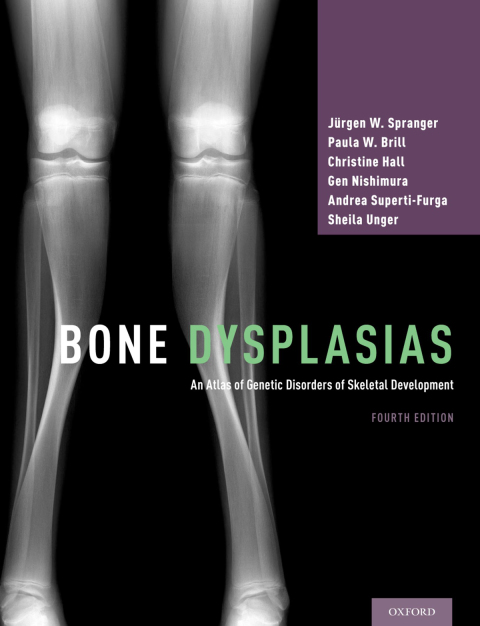 Cover image for book Bone Dysplasias