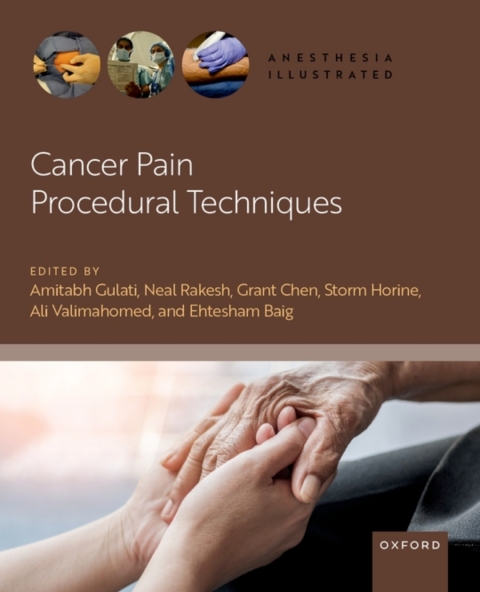 Cover image for book Cancer Pain Procedural Techniques