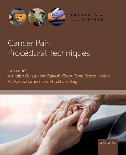 Cover image for book Cancer Pain Procedural Techniques