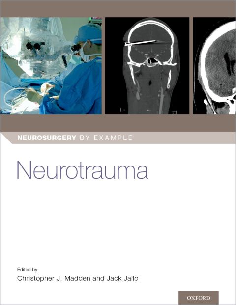 Cover image for book Neurotrauma