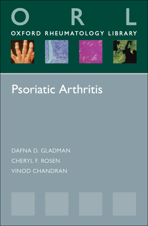 Cover image for book Psoriatic Arthritis