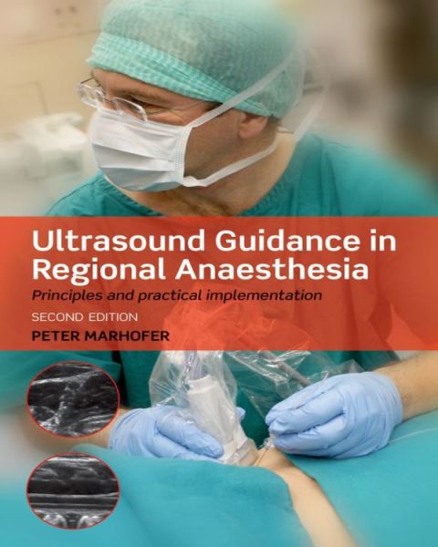 Cover image for book Ultrasound Guidance in Regional Anaesthesia