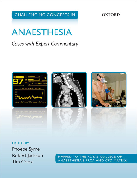 Cover image for book Challenging Concepts in Anaesthesia