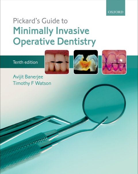 Cover image for book Pickard's Guide to Minimally Invasive Operative Dentistry