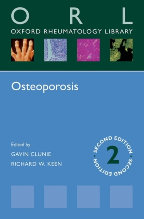 Cover image for book Osteoporosis