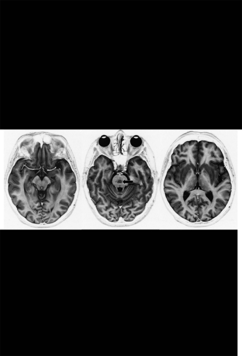 Cover image for book Neurological Case Histories