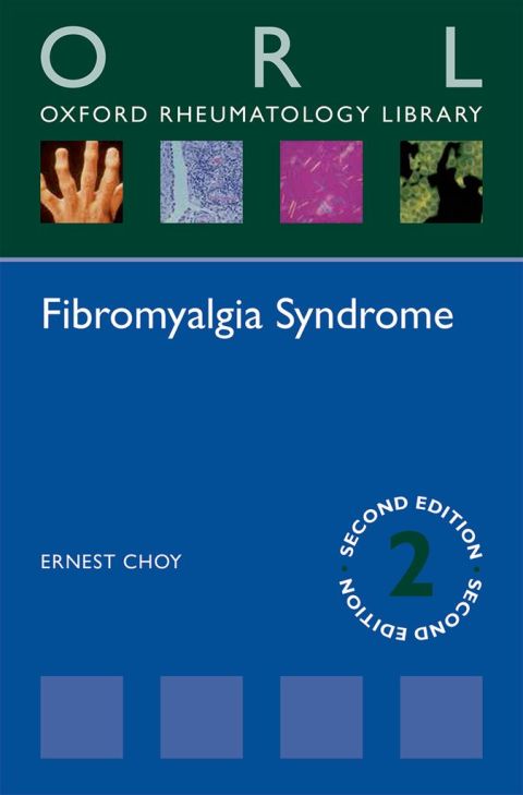 Cover image for book Fibromyalgia Syndrome