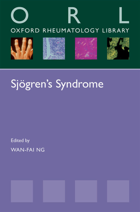 Cover image for book Sjögren's Syndrome