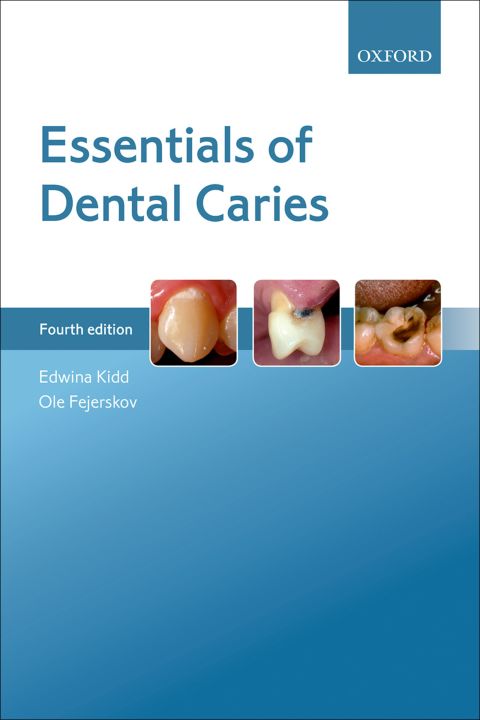 Cover image for book Essentials of Dental Caries