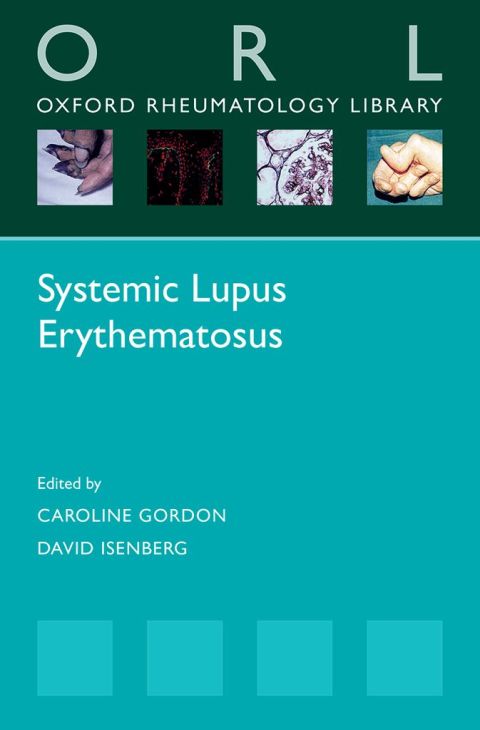 Cover image for book Systemic Lupus Erythematosus