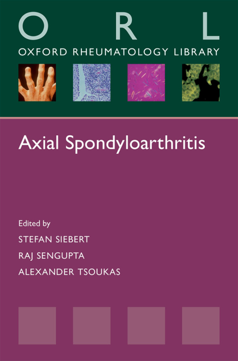 Cover image for book Axial Spondyloarthritis