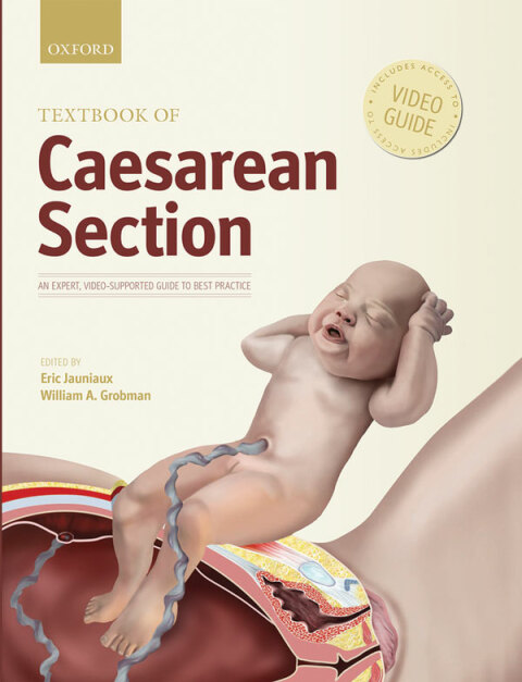 Cover image for book Textbook of Caesarean Section