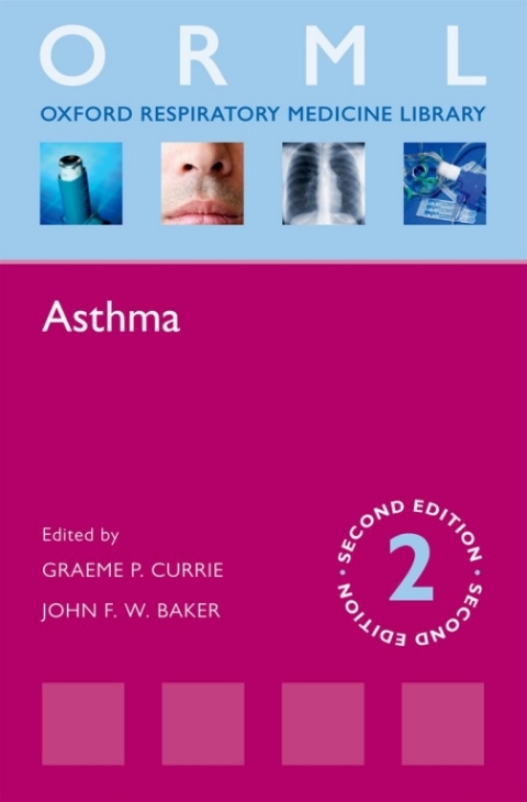 Cover image for book Asthma