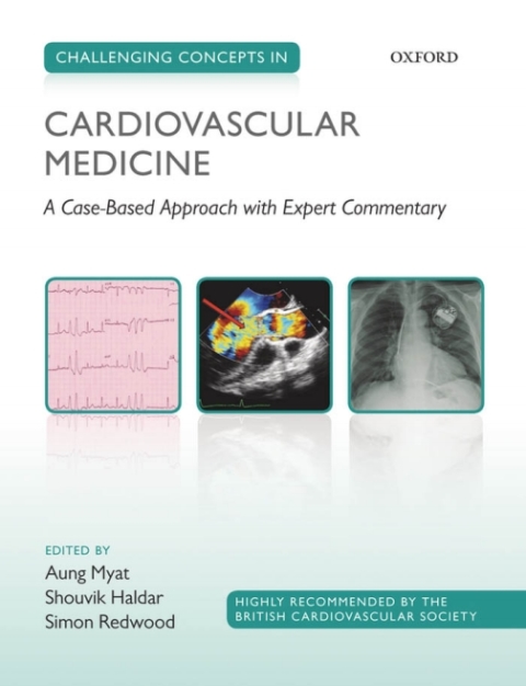 Cover image for book Challenging Concepts in Cardiovascular Medicine