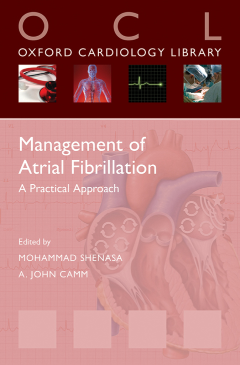 Cover image for book Management of Atrial Fibrillation