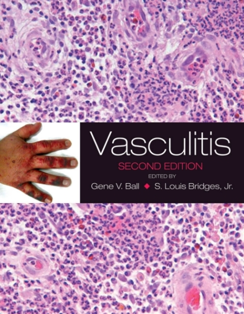 Cover image for book Vasculitis