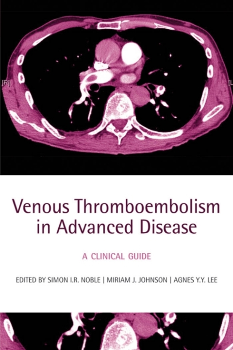 Cover image for book Venous Thromboembolism in Advanced Disease