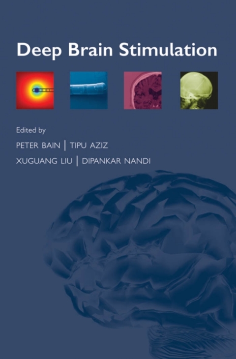Cover image for book Deep Brain Stimulation
