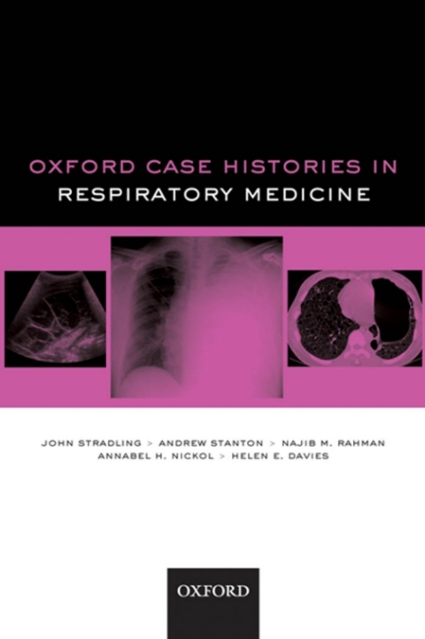 Cover image for book Oxford Case Histories in Respiratory Medicine