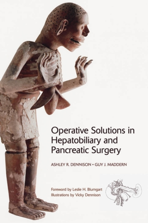 Cover image for book Operative Solutions in Hepatobiliary and Pancreatic Surgery