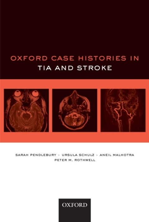 Cover image for book Oxford Case Histories in TIA and Stroke