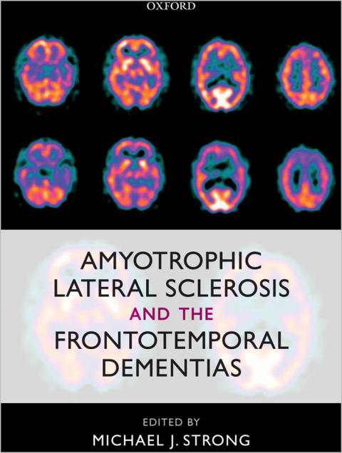 Cover image for book Amyotrophic Lateral Sclerosis and the Frontotemporal Dementias